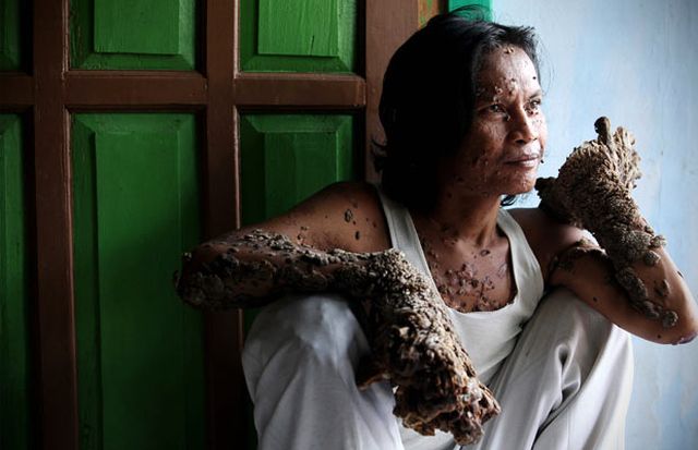 Have You Ever Seen a Tree Man? (19 pics)