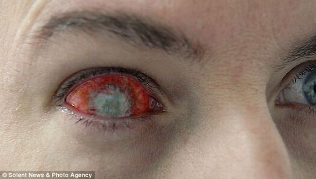 Freaky Contact Lenses (7 pics)