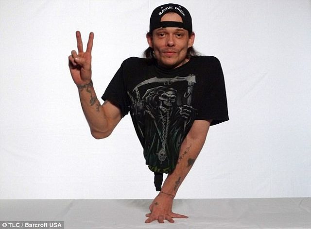 The Man with Half a Body! (33 pics) The Man with Half a Body! (33 pics)