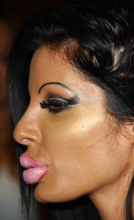 “Monster” Smile (16 pics)