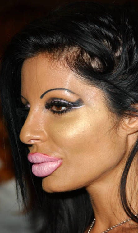 “Monster” Smile (16 pics)