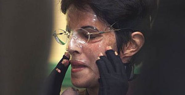 Incredible Healing after a Bomb Explosion (15 pics) Incredible Healing after a Bomb Explosion (15 pics)