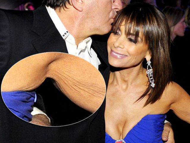 Celebrities Aren’t Perfect (31 pics) Celebrities Aren’t Perfect (31 pics)