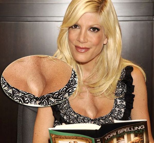 Celebrities Aren’t Perfect (31 pics) Celebrities Aren’t Perfect (31 pics)