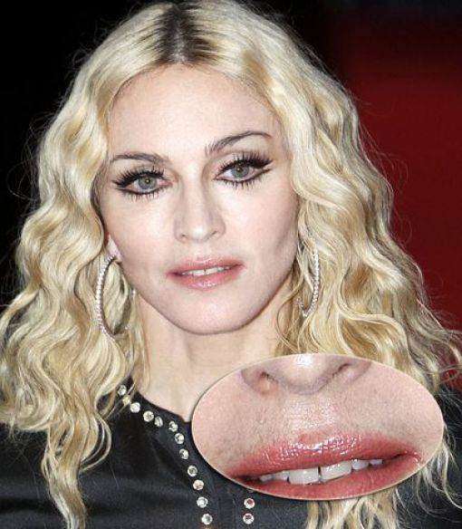 Celebrities Aren’t Perfect (31 pics) Celebrities Aren’t Perfect (31 pics)