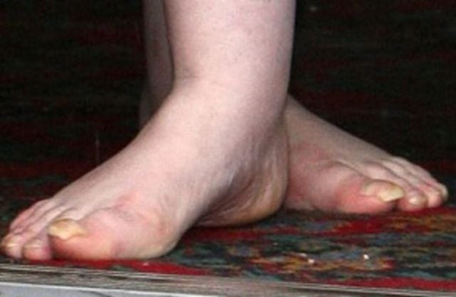 Famous Women with Ugly Feet (21 pics)