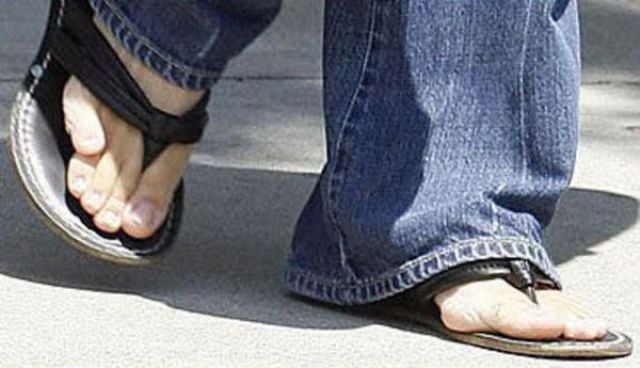 Famous Women with Ugly Feet (21 pics)