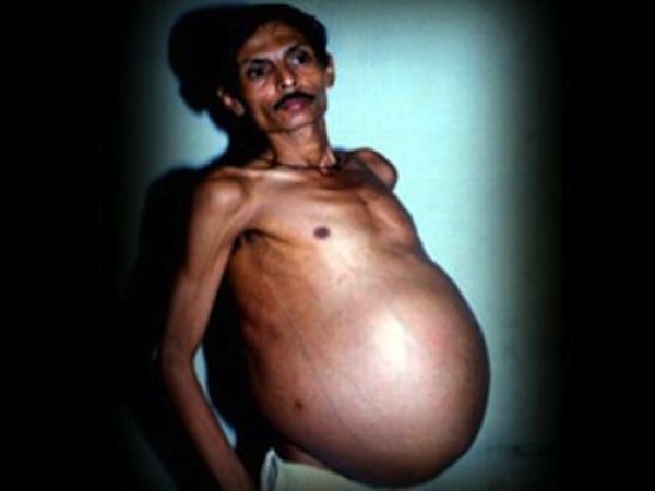 Best Beer Bellies (25 pics)