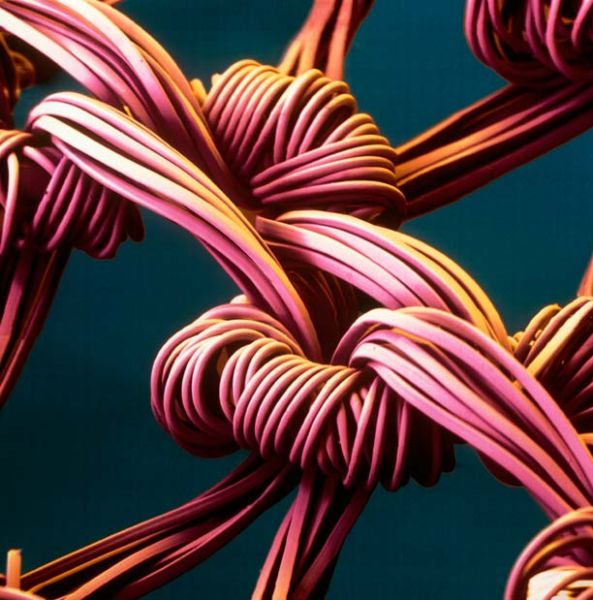 Amazing Scanning Electron Microscope Pictures