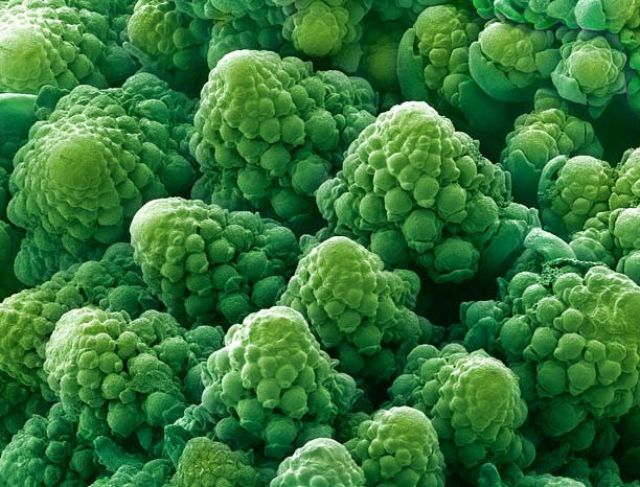 Amazing Scanning Electron Microscope Pictures