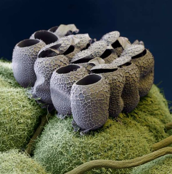 Amazing Scanning Electron Microscope Pictures