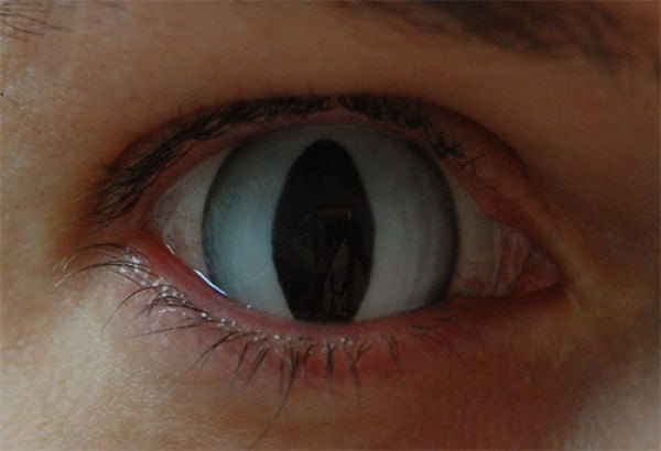 Eerie Eyeball Covers