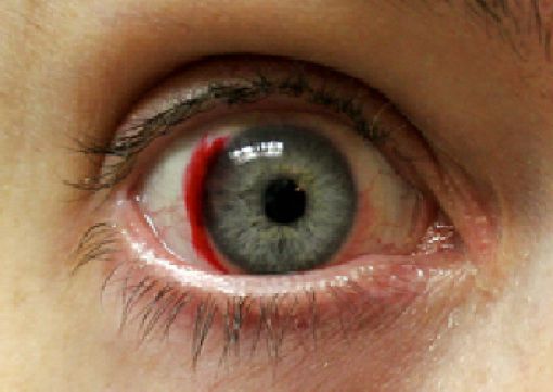 Eerie Eyeball Covers