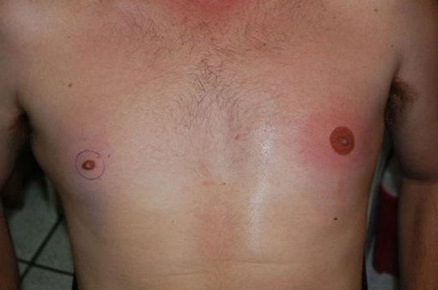 If Your Nipples Are Too Small