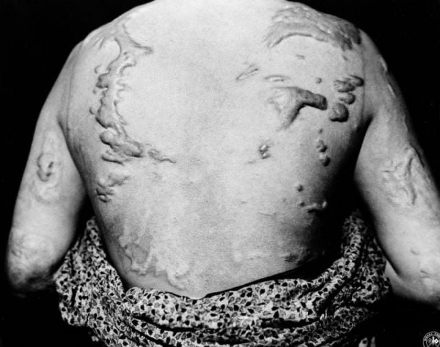 Frightening Hiroshima and Nagasaki Atomic Bomb Pictures