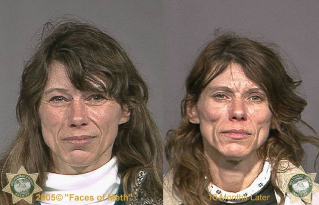 Meth Addicts: Before and After