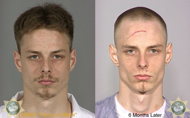 Meth Addicts: Before and After