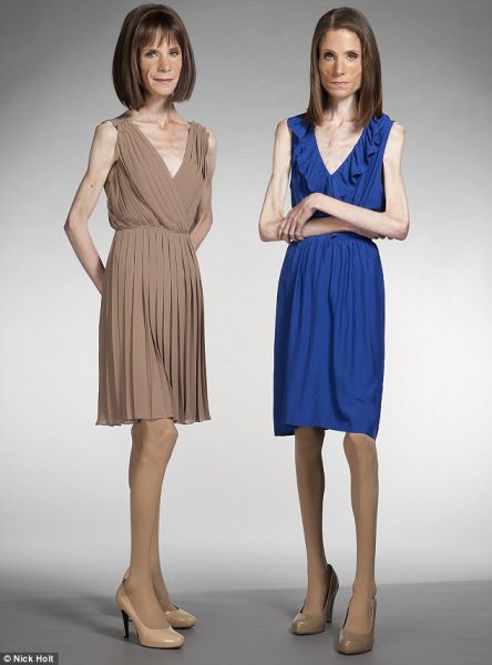 Anorexic Twins Disturbing Pact