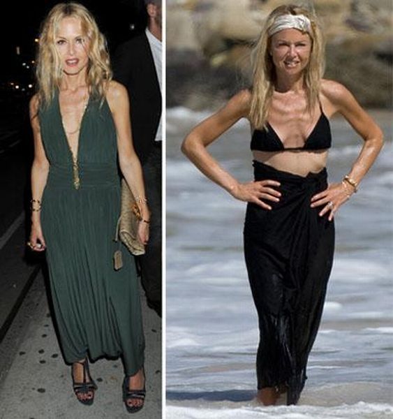 Slimmed Down Celebrities