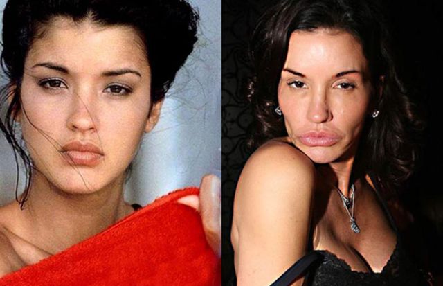 From Hottie to Ugly: Female Celebtrites Who Were Hot