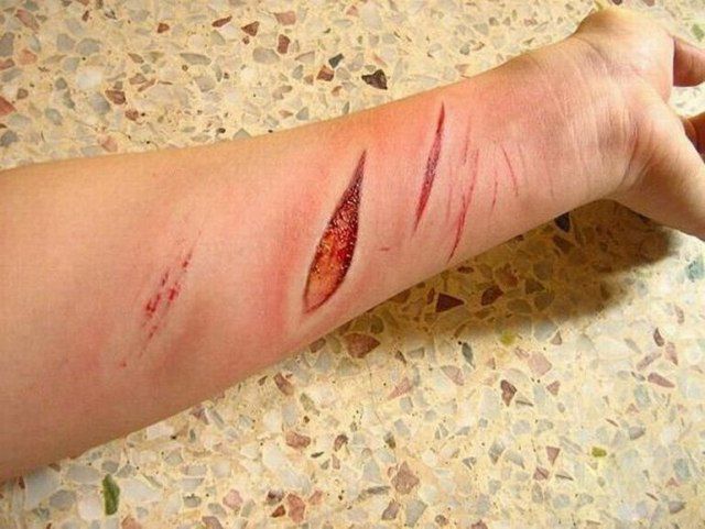 Are These Horrible Hand Wounds Real?