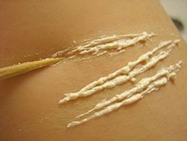 Are These Horrible Hand Wounds Real?