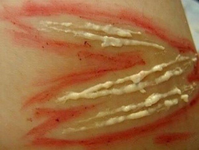 Are These Horrible Hand Wounds Real?