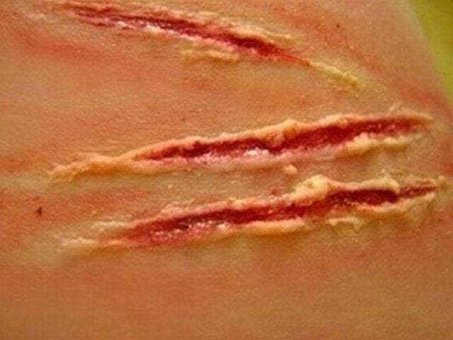 Are These Horrible Hand Wounds Real?