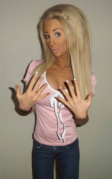Swedish Blonde Had a Dozen Plastic Surgeries