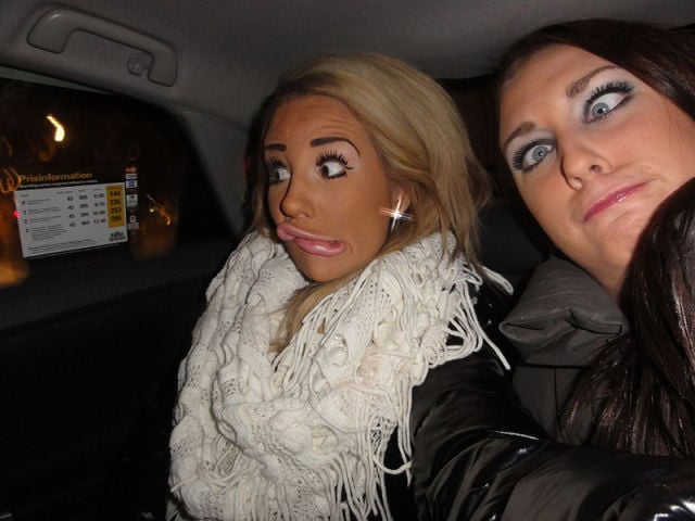 Swedish Blonde Had a Dozen Plastic Surgeries