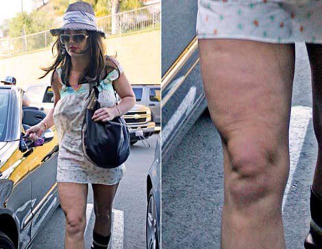 Awkward Moments for Celebrities