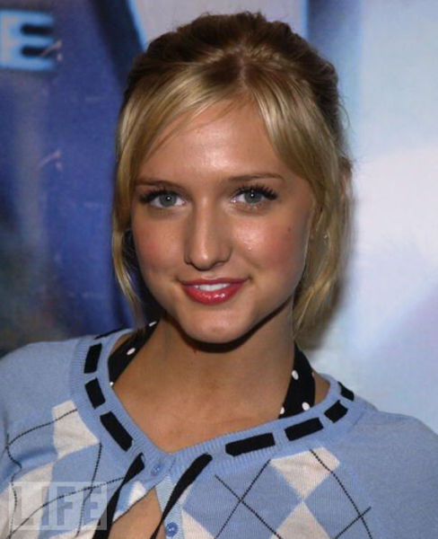 Celebrity Plastic Surgery Before & After