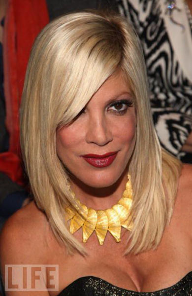 Celebrity Plastic Surgery Before & After