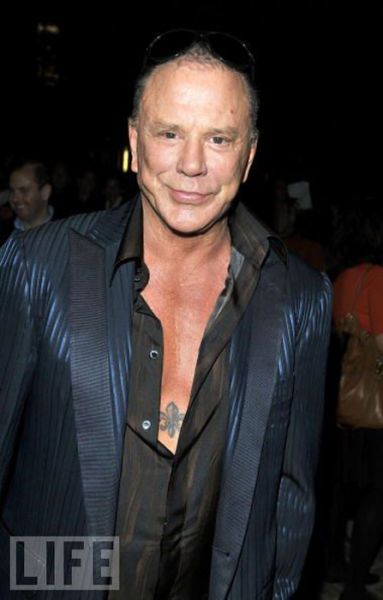 Celebrity Plastic Surgery Before & After