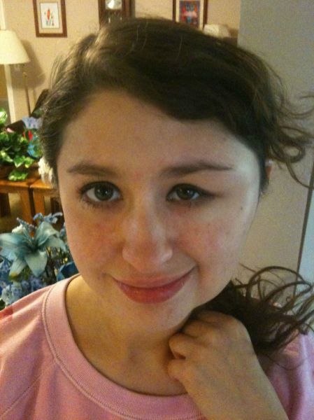 What a Brown Recluse Spider Bite Looks Like