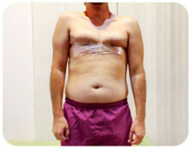 Is That Cleavage Real?