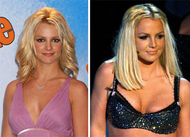 Celebs with the Worst Fake Breasts: Before and After