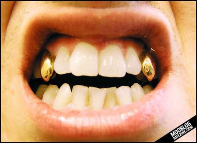 Wacky Body Modifications