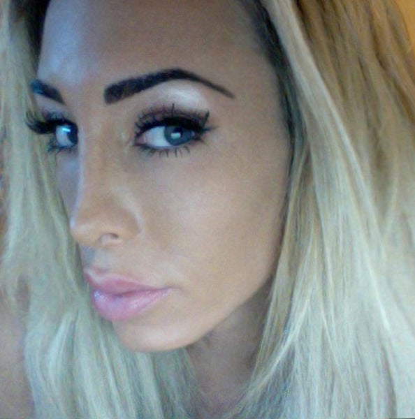 The Victim of Silicone