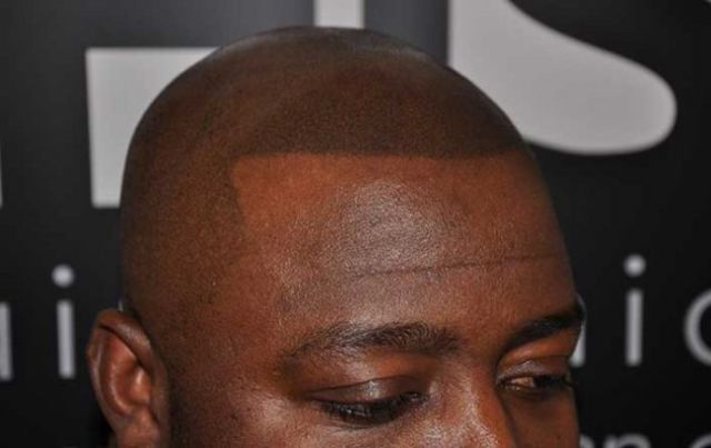 The ‘No Hair’ Solution!