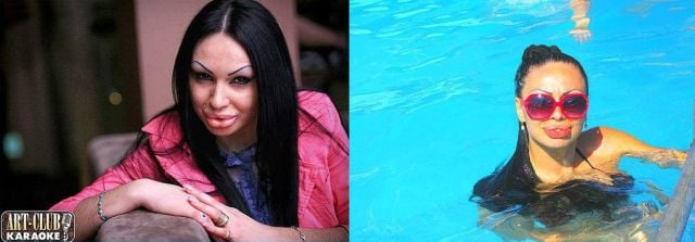 Sometimes Beauty Treatments Just Make You Ugly