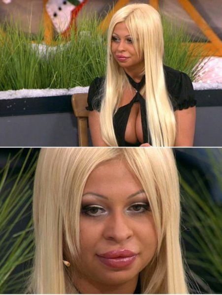 Sometimes Beauty Treatments Just Make You Ugly