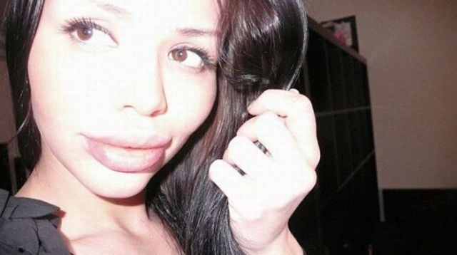 Sometimes Beauty Treatments Just Make You Ugly