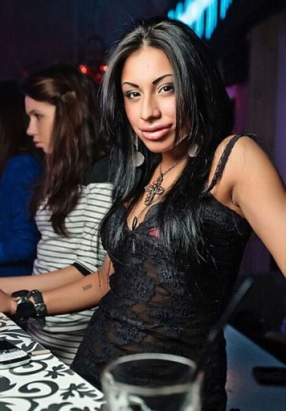 Sometimes Beauty Treatments Just Make You Ugly