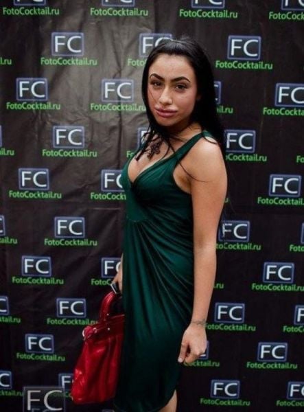 Sometimes Beauty Treatments Just Make You Ugly