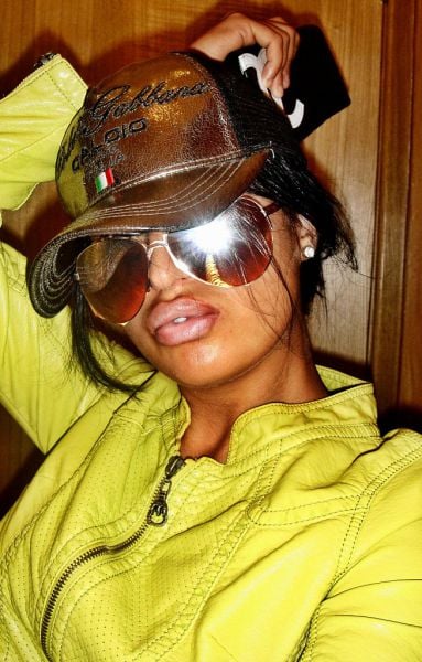 Sometimes Beauty Treatments Just Make You Ugly