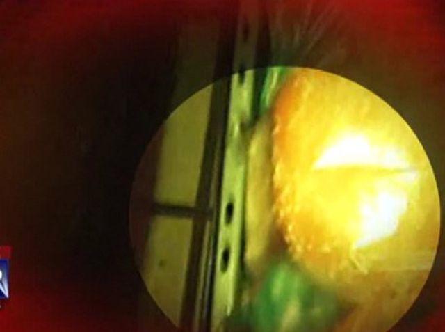 Truly Disgusting Things People Have Found in Their Food