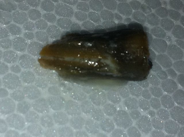 Truly Disgusting Things People Have Found in Their Food