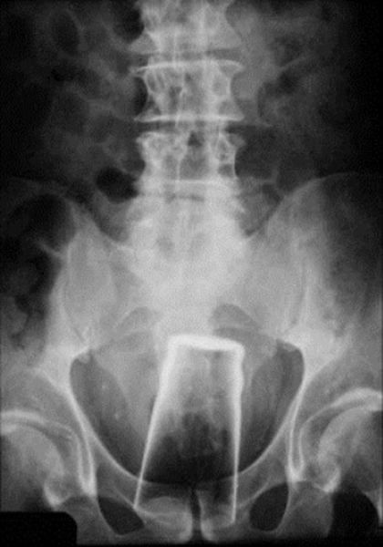 Real X-Rays That Will Shock and Astound You