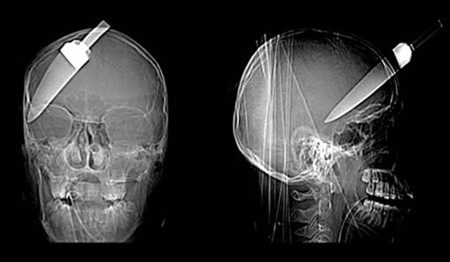 Real X-Rays That Will Shock and Astound You